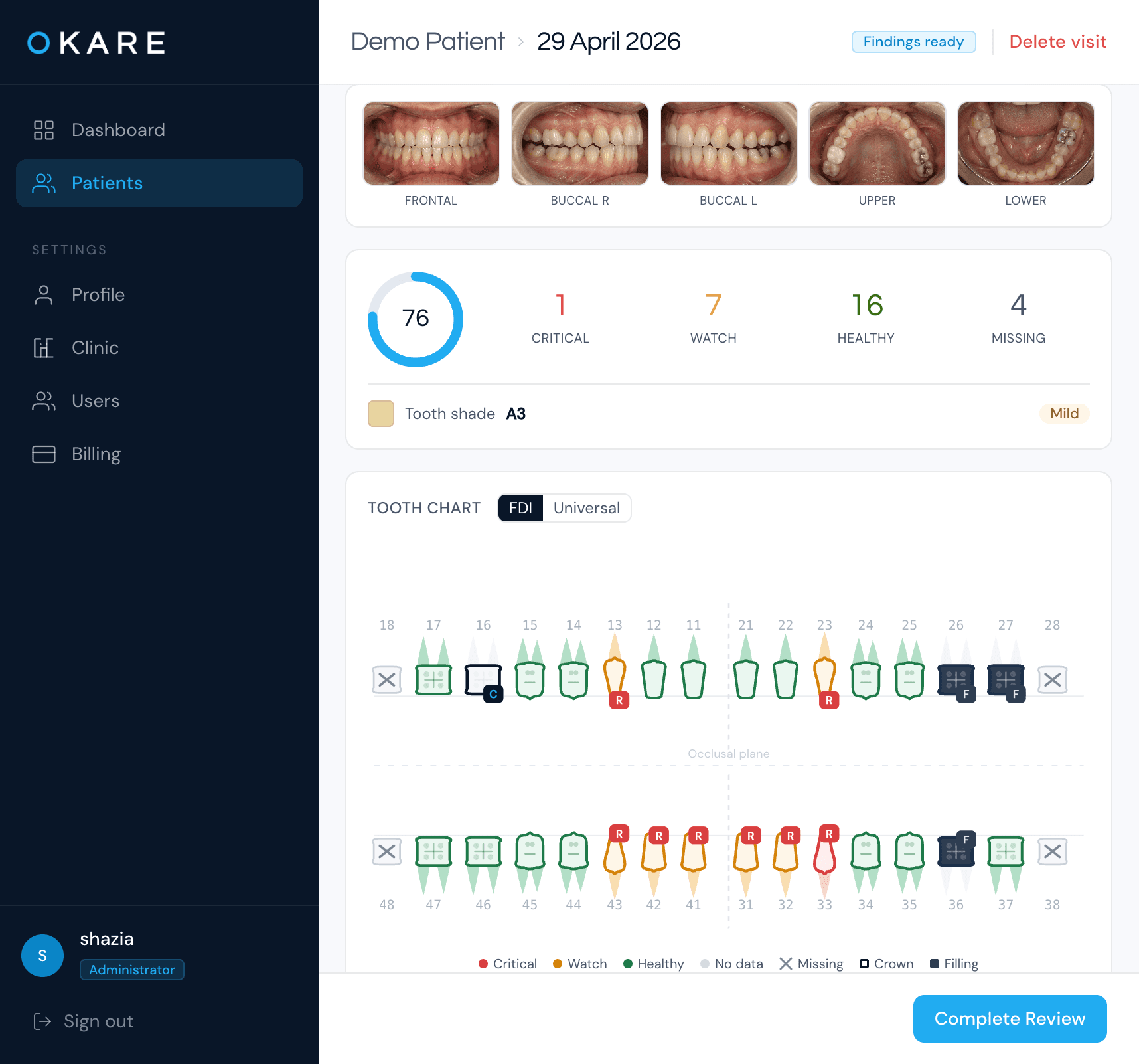 Okare Clinic — AI-generated odontogram ready for dentist review